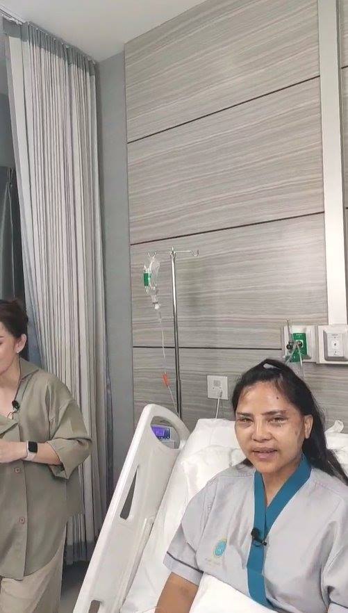 สุนารี ศัลยกรรมหน้า