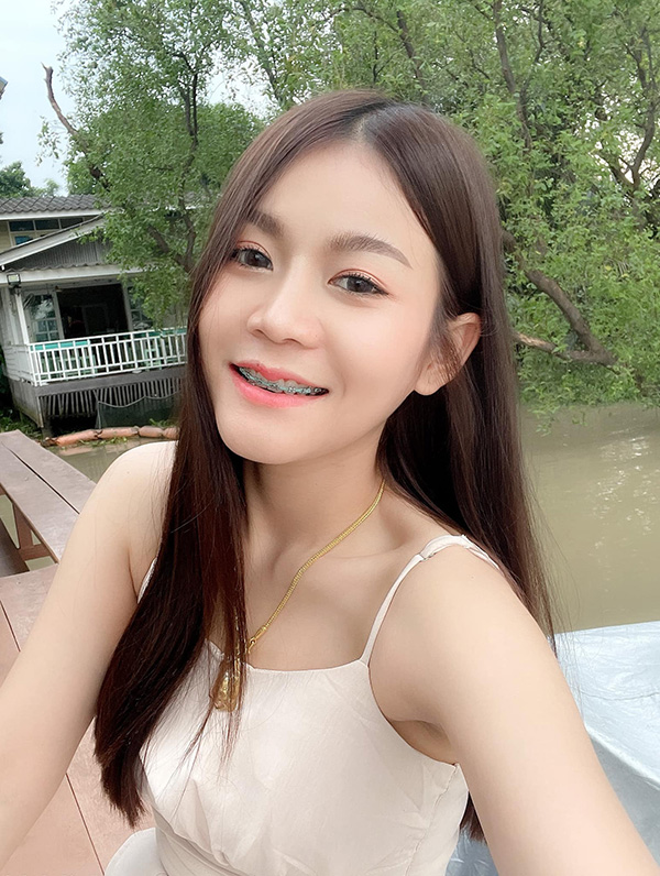 ครูเบียร์ ก่อนศัลยกรรม ทำอะไรมาบ้าง พร้อมอัปเดตพัฒนาการความสวยล่าสุด