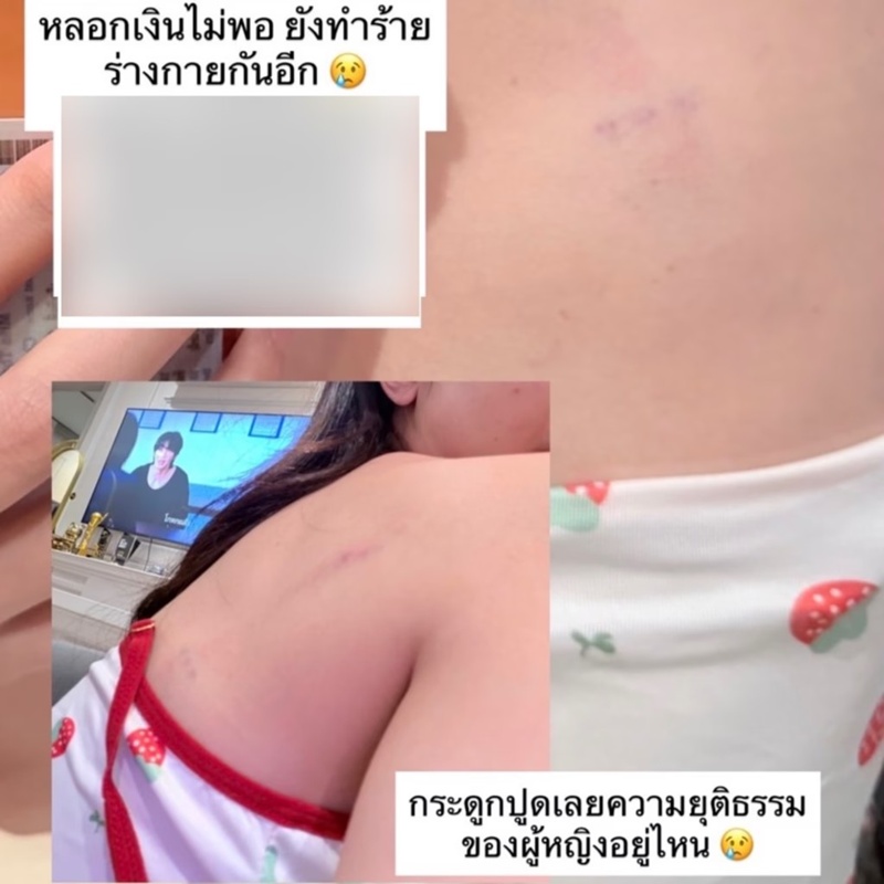 อินฟลูฯ สาว แฉ ถูกดาราดังทำร้ายร่างกาย