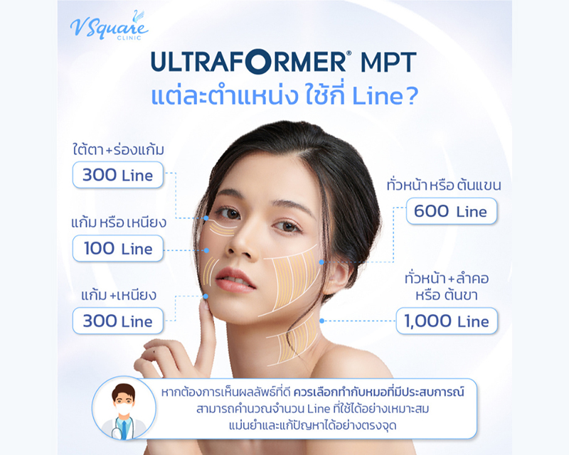 ราคา Ultraformer MPT ใช้กี่ไลน์