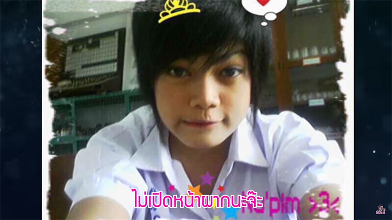 พิมรี่พาย ศัลยกรรม