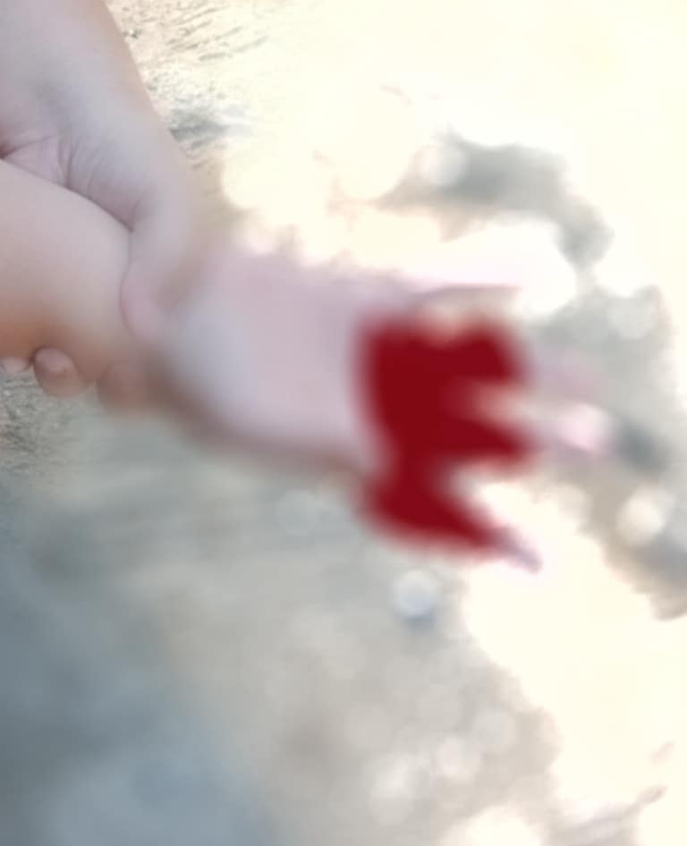 ประทัดกระเทียม