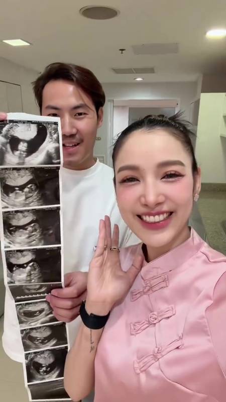 แพท ณปภา ตั้งท้องลูกคนที่สอง