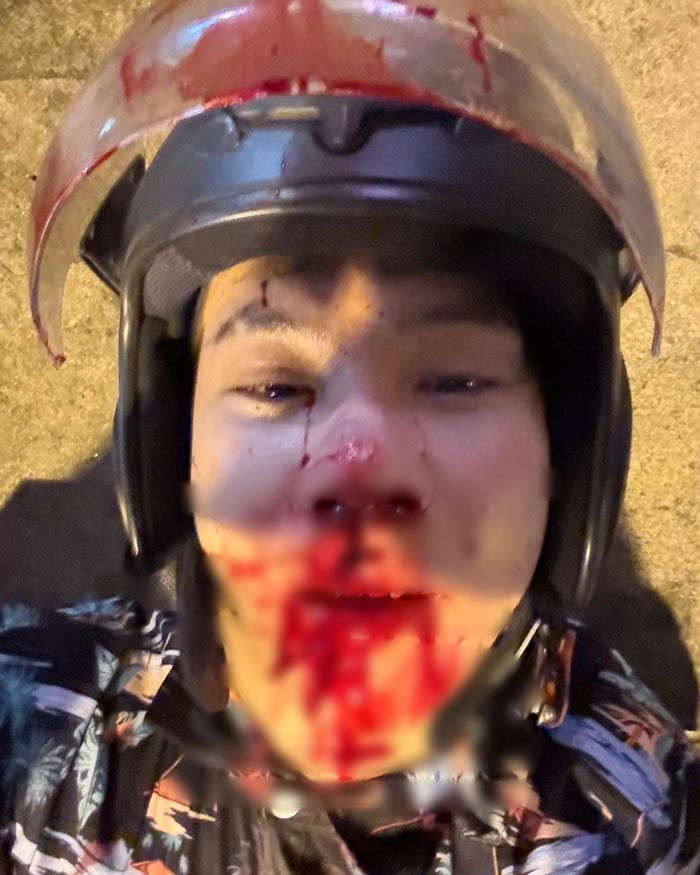 ตั้ม วราวุธ อุบัติเหตุรถชน