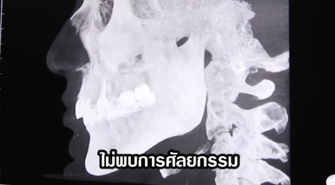 ใหม่ ดาวิกา