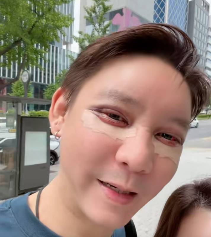 จิน จรินทร์ ศัลยกรรม
