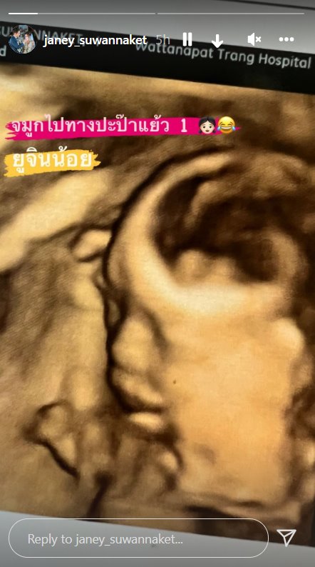 น้องยูจิน