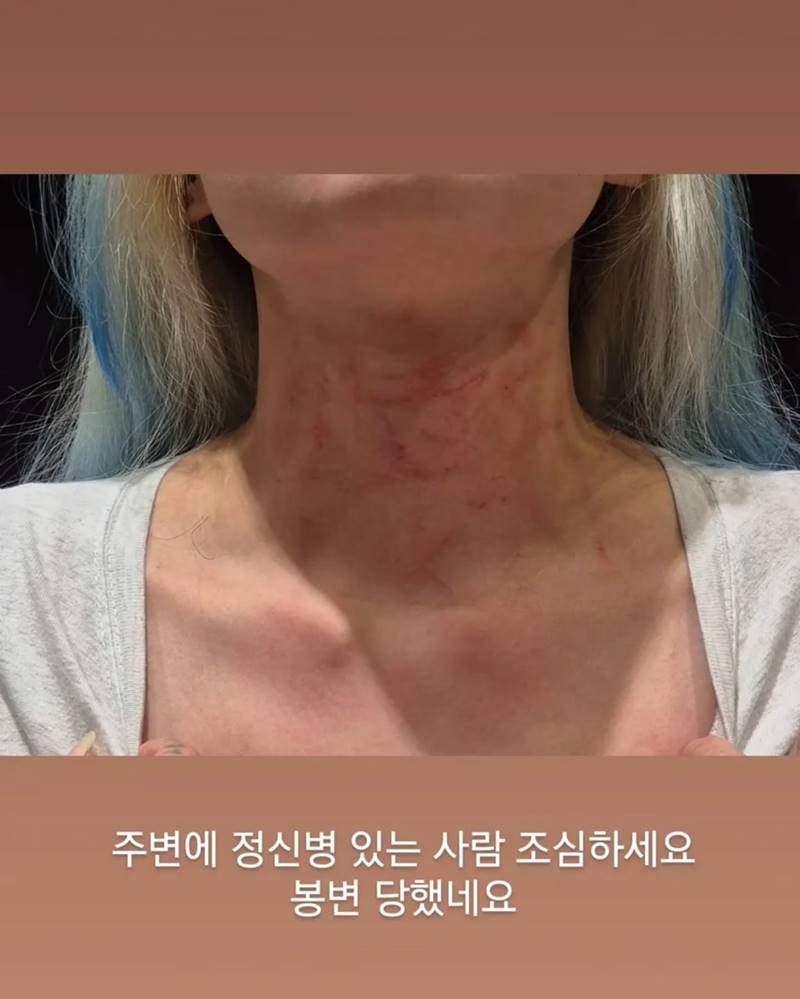 ชเวฮยอนจอง วง Rolling Quartz