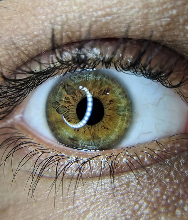 ภาพถ่ายดวงตามนุษย์