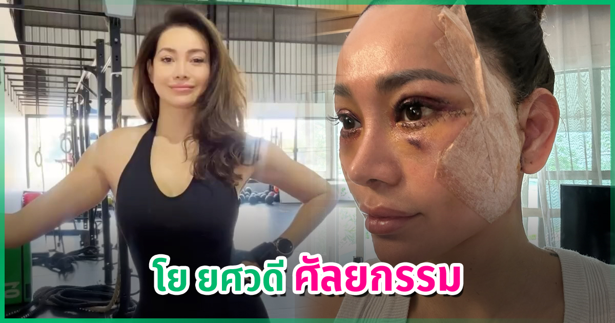 Yo Yossavadee Reveals Stunning Results After Full Face Lift in Korea at 47
