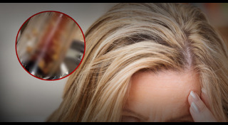 หนอนในปากคน