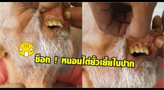 หนอนในปากคน