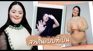 ดาวน์ซินโดรม