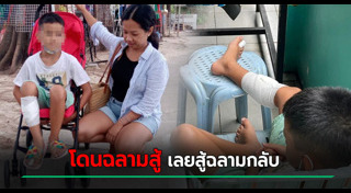 ฉลามกัดคน