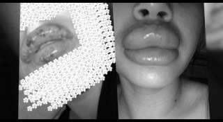 ศัลยกรรมปาก