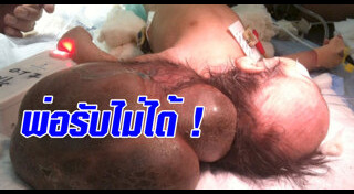 ร่างกายผิดปกติ