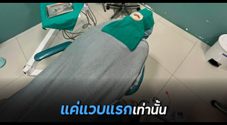 ถอนฟัน
