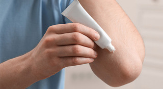 เชื้อราบนหนังศีรษะ