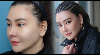 ดาราศัลยกรรม