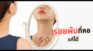 เคล็ดลับผิวสวย
