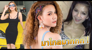 นักร้องศัลยกรรม