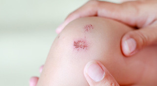 การปฐมพยาบาล