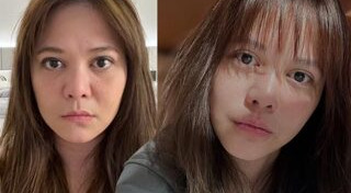 ศัลยกรรมหน้า