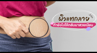 ผิวแตกลาย