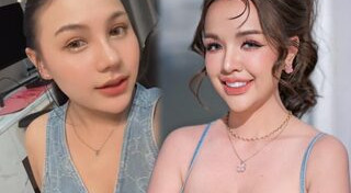 ศัลยกรรมจมูก