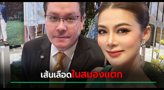 เส้นเลือดสมองแตก