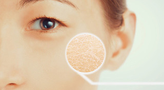 ผิวแห้ง