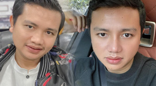 พัฒนาการความหล่อ