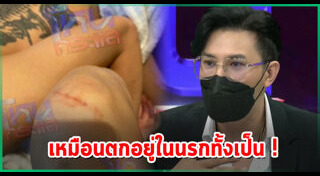 ดาราถูกทำร้ายร่างกาย
