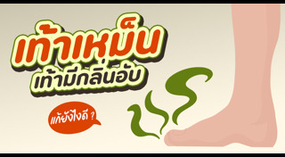 เท้าเหม็น