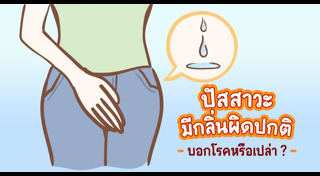 สีปัสสาวะบอกโรค