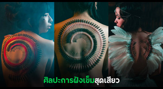 ฝังเข็ม