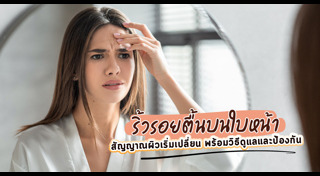 ริ้วรอย