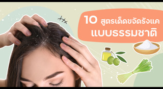 วิธีขจัดรังแค