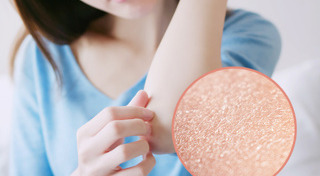 วิธีดูแลผิวหน้าหนาว