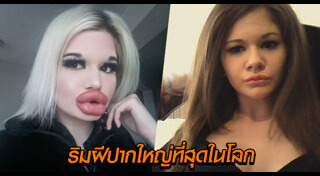 ศัลยกรรมแปลกๆ