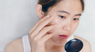 รอยแผลเป็น