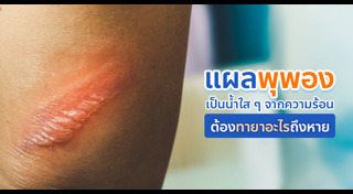 การปฐมพยาบาล