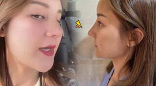 ดาราศัลยกรรมจมูก