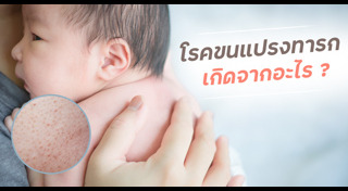 โรคเด็ก