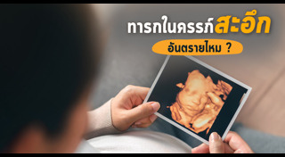 พัฒนาการทารก