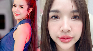 ดาราศัลยกรรมปาก