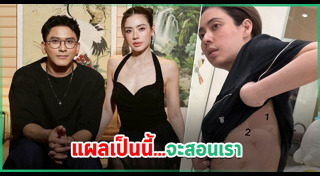 ป๋อ เอ๋