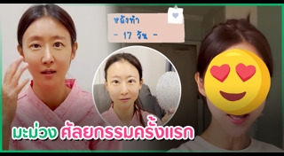 ศัลยกรรมตา