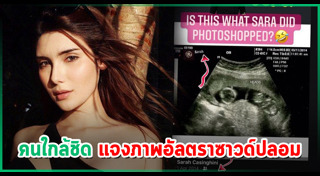 อัลตราซาวด์