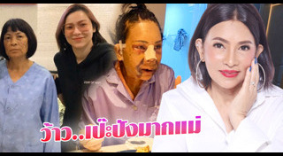 ศัลยกรรมเกาหลี